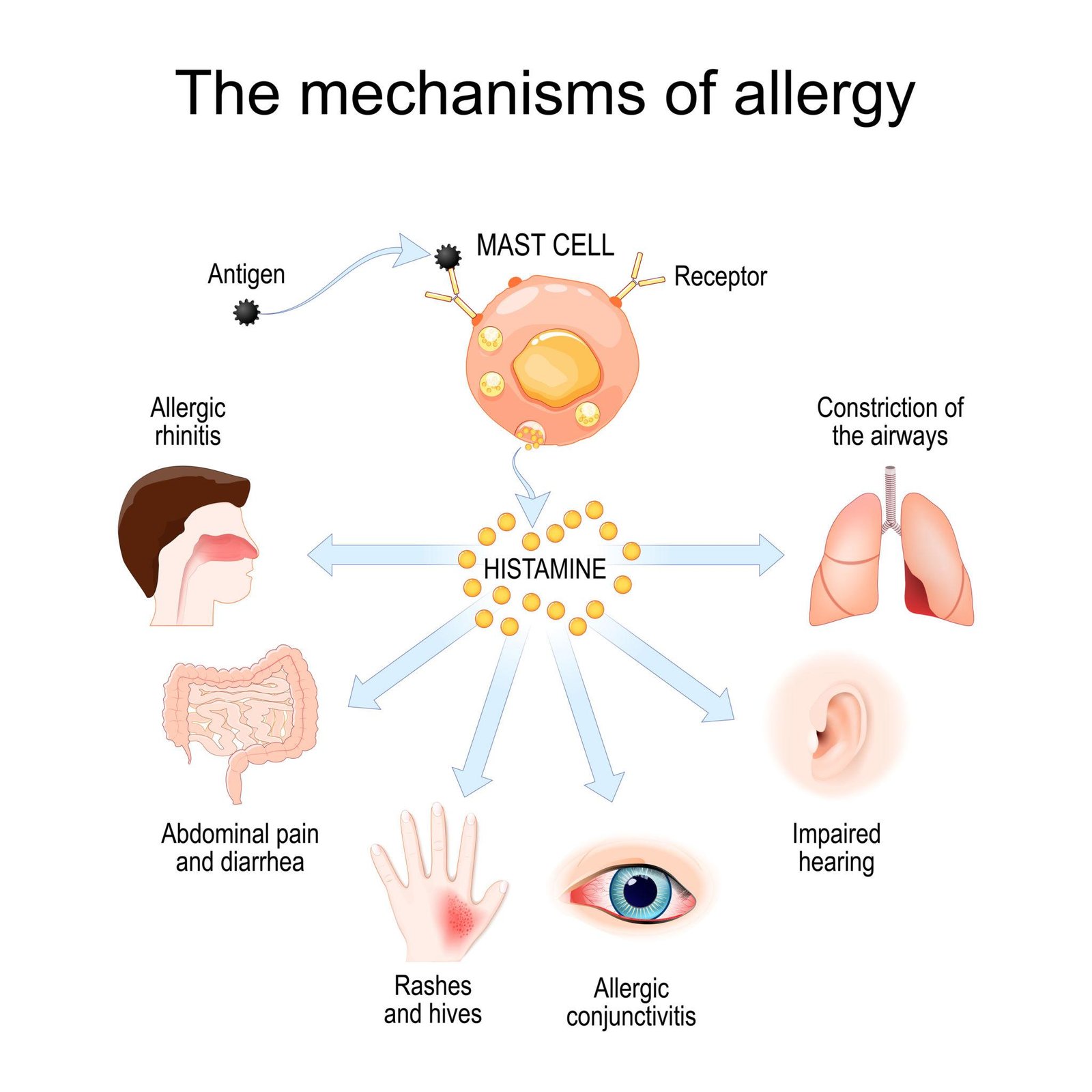 Hypersensitivity reactions